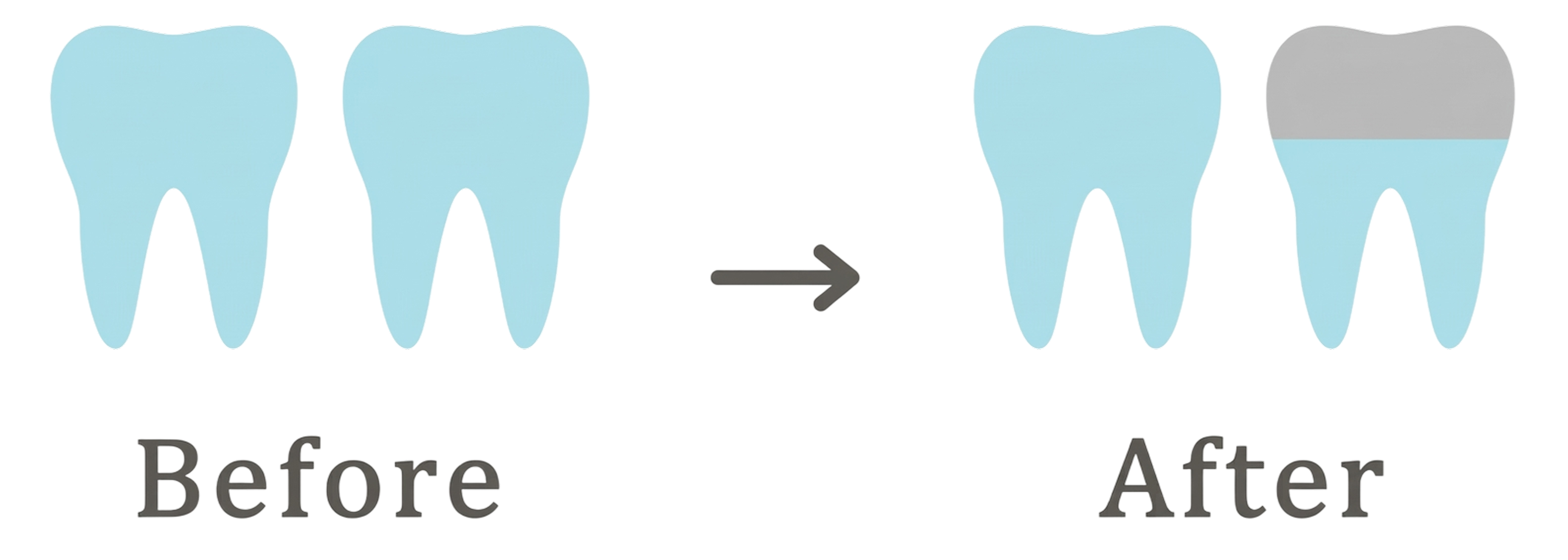 30代からメインテナンスを開始した場合の歯の比較