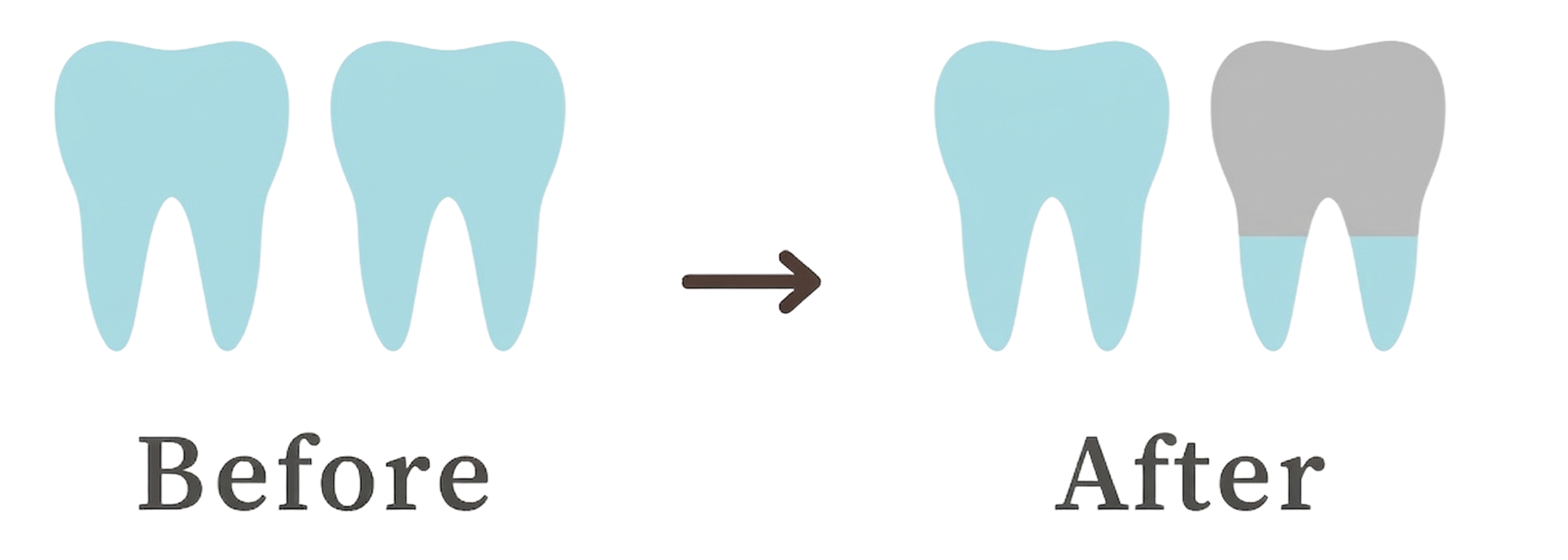 40代からメインテナンスを開始した場合の歯の比較