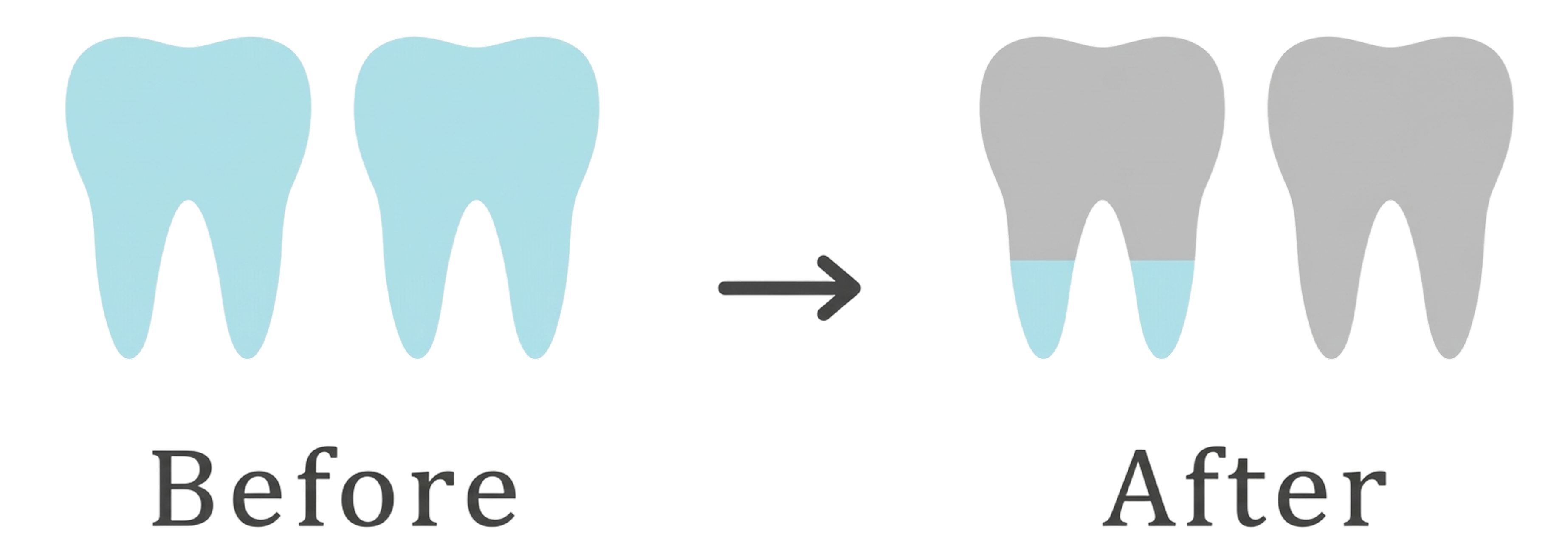 50代からメインテナンスを開始した場合の歯の比較