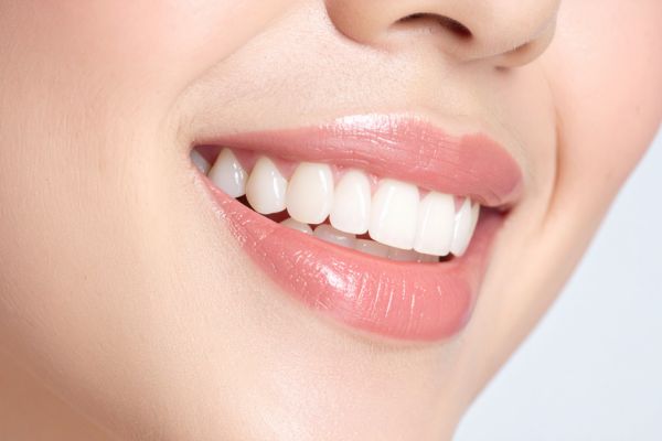 ホワイトニング前のクリーニング（プレケア）の様子